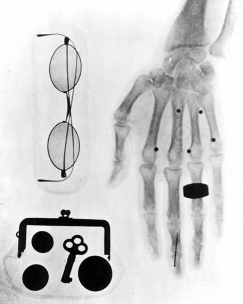 1896 - First X-ray image in Japan